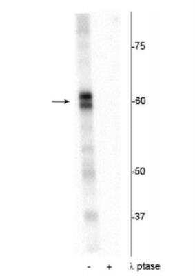 Western Blot: PRAS40 [p Thr356] Antibody [NBP2-60783]